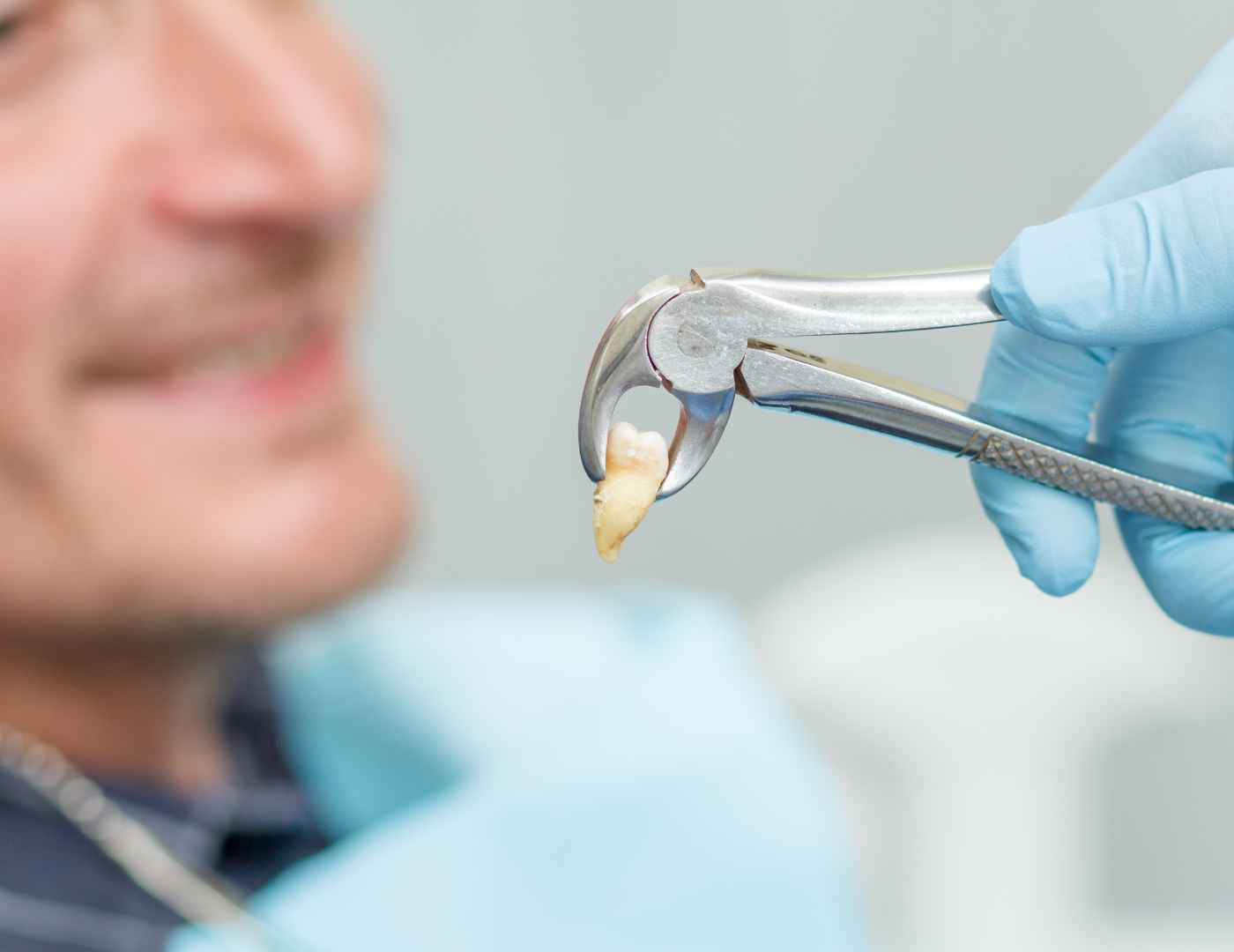 Tooth Extraction