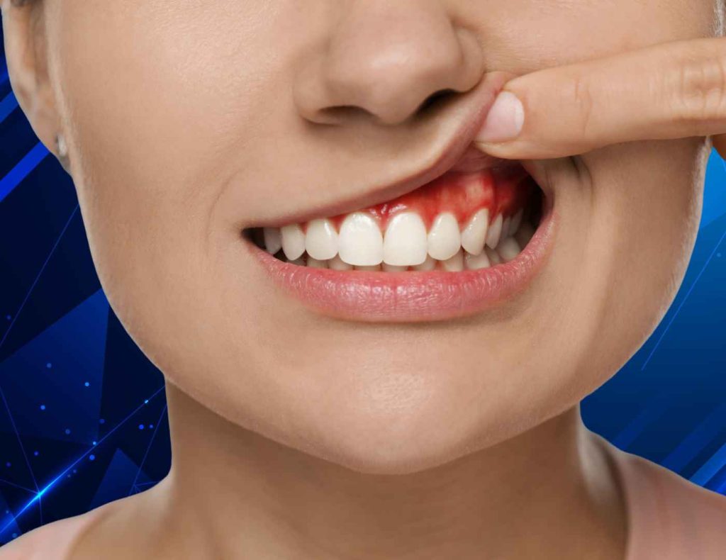 Tooth Abscess Healing Timeline