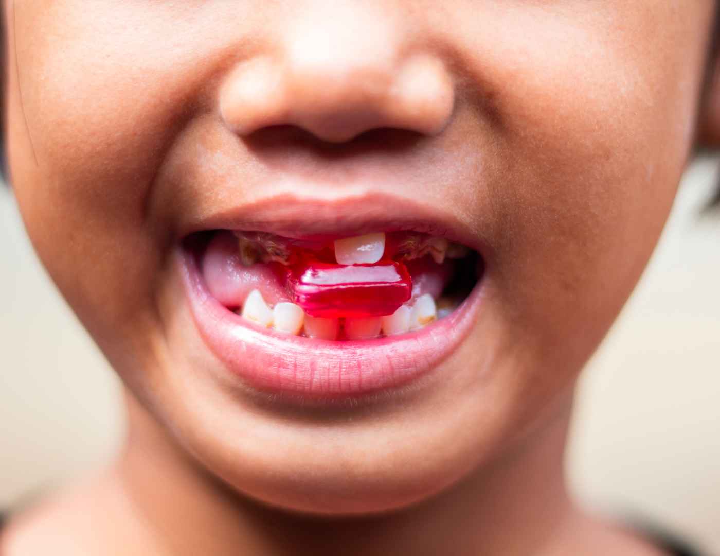 bleeding gums in children causes